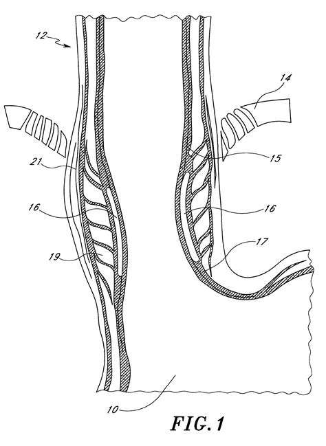 submucosal delivery