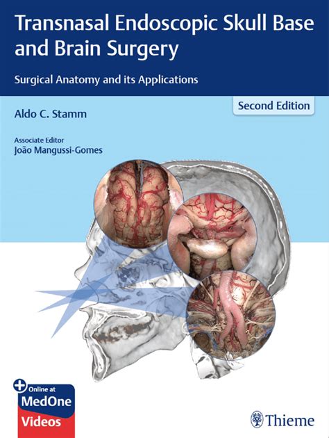 surgery of cranial base free read Epub