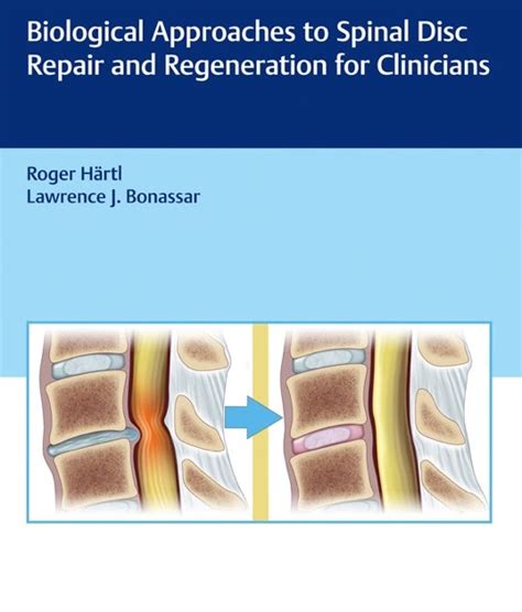 surgery to repair herniated disc pdf Kindle Editon