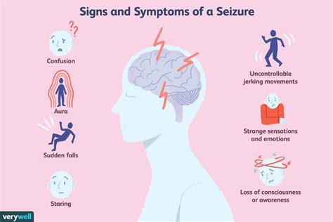 symptoms of a seizure