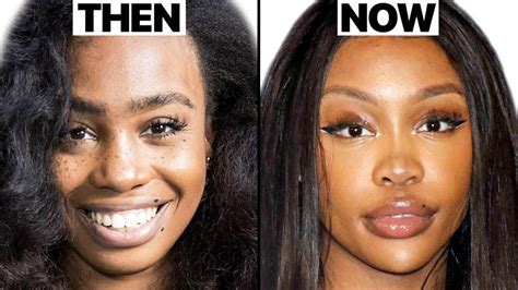 sza before surgery