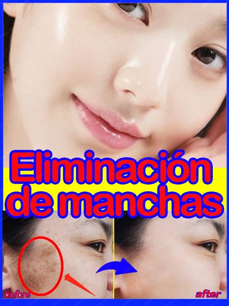 t cnicas de eliminaci n de manchas t cnicas de eliminaci n de manchas Doc