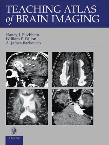 teaching atlas of brain imaging teaching atlas series PDF