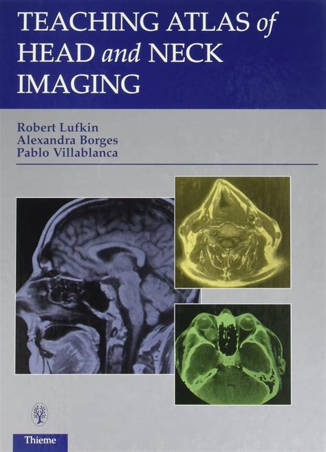 teaching atlas of head and neck imaging Reader