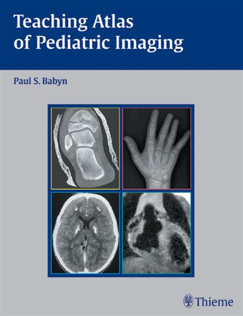 teaching atlas of pediatric imaging teaching atlas series Kindle Editon