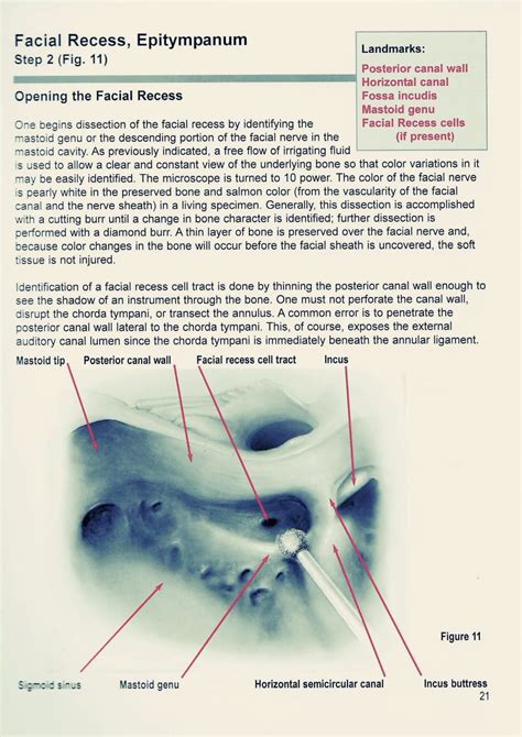 temporal bone dissection manual Doc