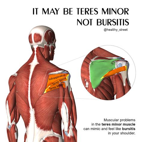 teres major muscle pain