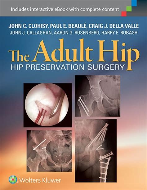 the adult hip hip preservation surgery Epub