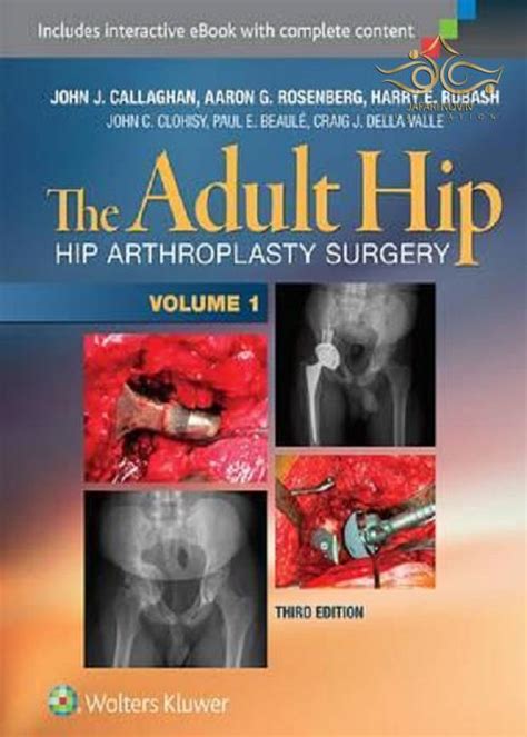 the adult hip volume 1 the adult hip volume 1 Epub