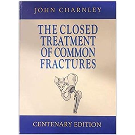 the closed treatment of common fractures Epub