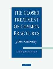 the closed treatment of common fractures Epub