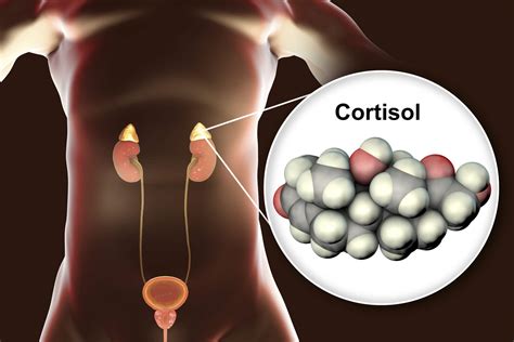 the cortisol connection the cortisol connection Epub