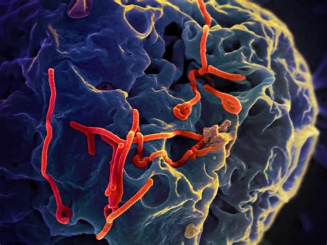 the ebola virus diseases and disorders Reader