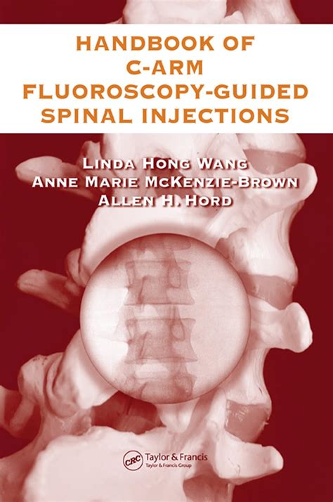 the handbook of c arm fluoroscopy guided spinal injections Kindle Editon