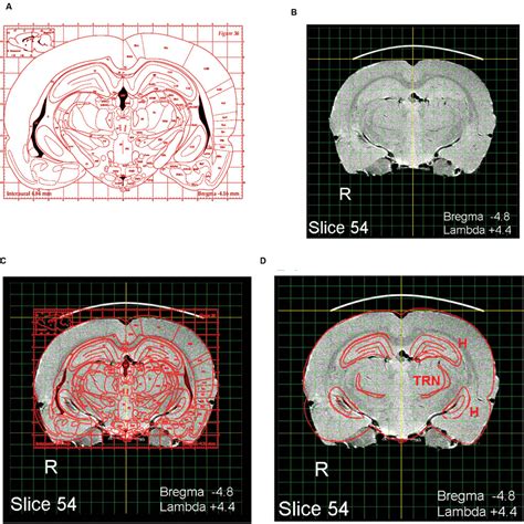 the rat brain in stereotaxic Kindle Editon