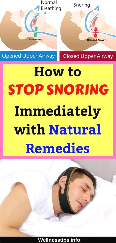 the snoring cure reclaiming yourself from sleep apnea Epub