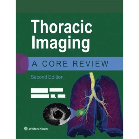 thoracic imaging a core review Doc