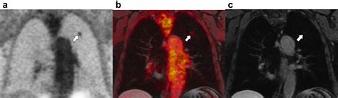 thoracic imaging thoracic imaging Reader