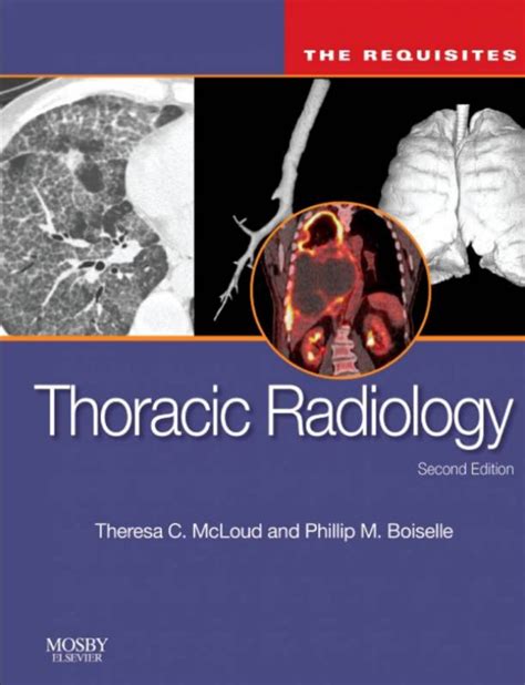 thoracic radiology the requisites 2e requisites in radiology PDF