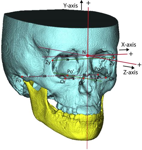 three dimensional cephalometry three dimensional cephalometry Epub