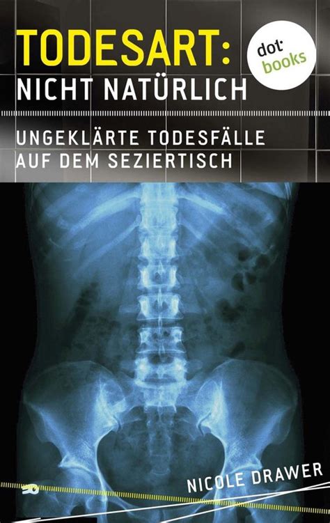 todesart nat rlich ungekl rte todesf lle seziertisch ebook PDF