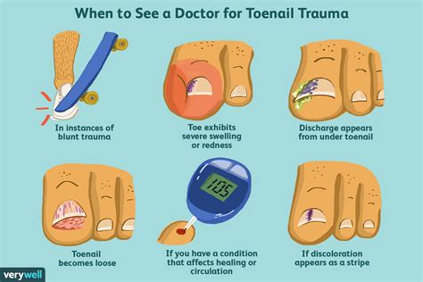 toenail hurts when pressed