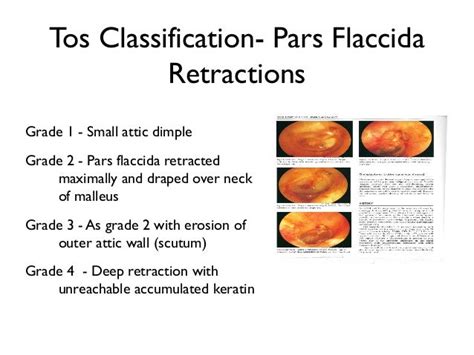 tos classification