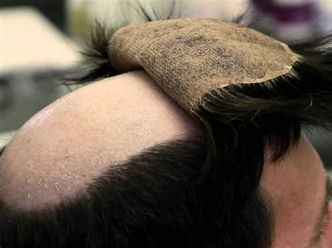 toupee system with hooks