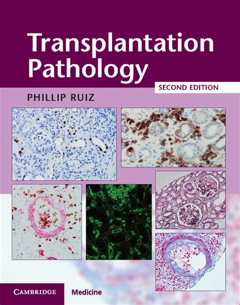 transplantation pathology cambridge medicine Reader