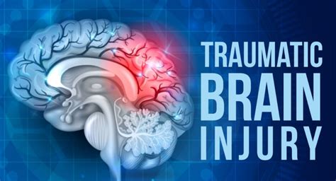 traumatic brain injury traumatic brain injury Epub