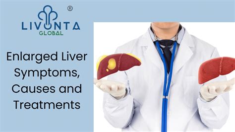 treatment for enlarged liver