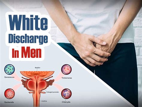 treatment of white discharge in male