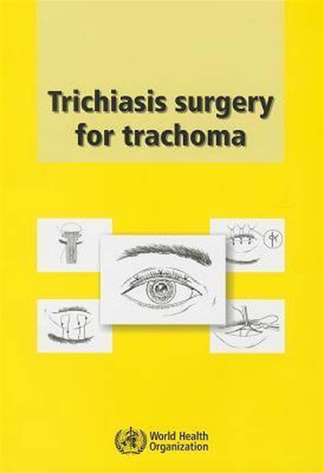 trichiasis surgery trachoma health organization Reader