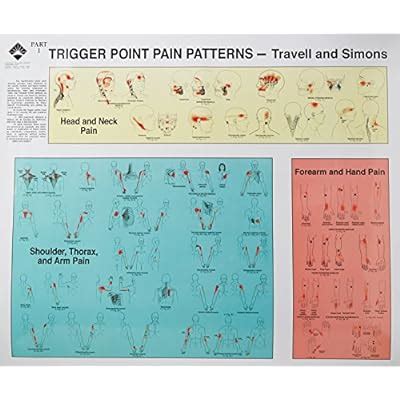 trigger points of pain wall charts set of 2 Doc