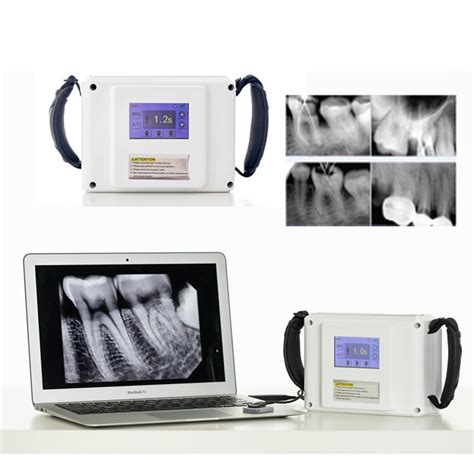 trophy dental x ray unit Kindle Editon