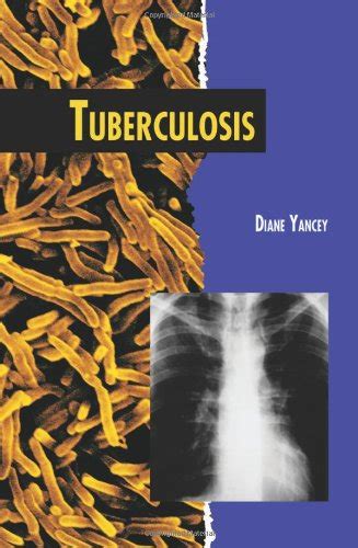 tuberculosis twenty first century medical library PDF