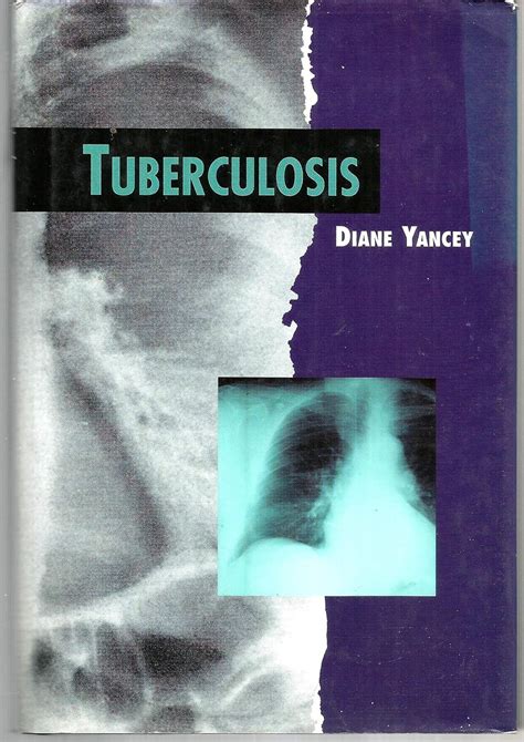 tuberculosis twenty first century medical library PDF