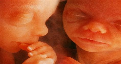 twins from fetus to child twins from fetus to child Epub