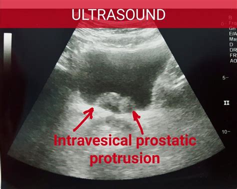 ultrasonography in urology ultrasonography in urology Kindle Editon