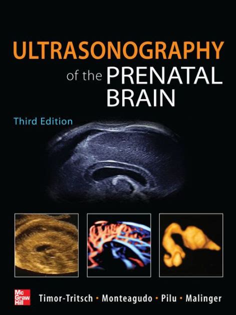 ultrasonography of the prenatal brain third edition Doc