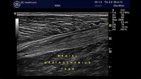 ultrasound of the musculoskeletal system medical radiology Reader