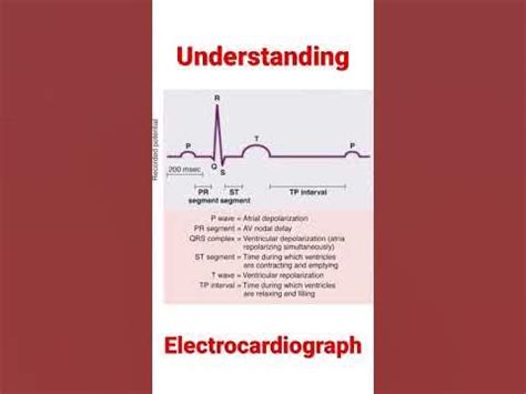 understanding electrocardiography understanding electrocardiography Reader