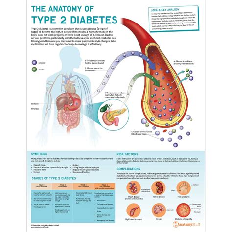 understanding type 2 diabetes anatomical chart Epub