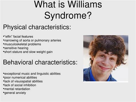 understanding williams syndrome understanding williams syndrome Kindle Editon