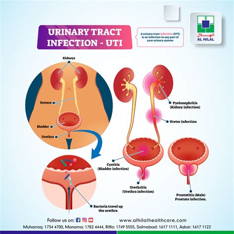 urinary tract infections (UTIs),