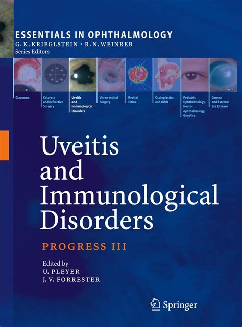 uveitis and immunological disorders uveitis and immunological disorders Epub