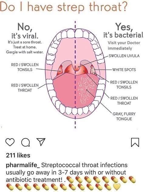 uvula ulcer manual guide pdf Reader