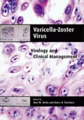 varicellazoster virus virology and clinical management Reader