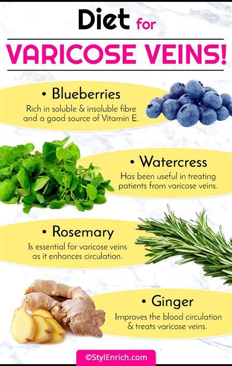 Varicose Veins Diet Chart