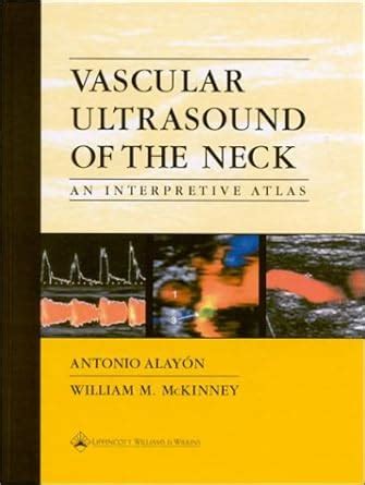vascular ultrasound of the neck an interpretive atlas Reader
